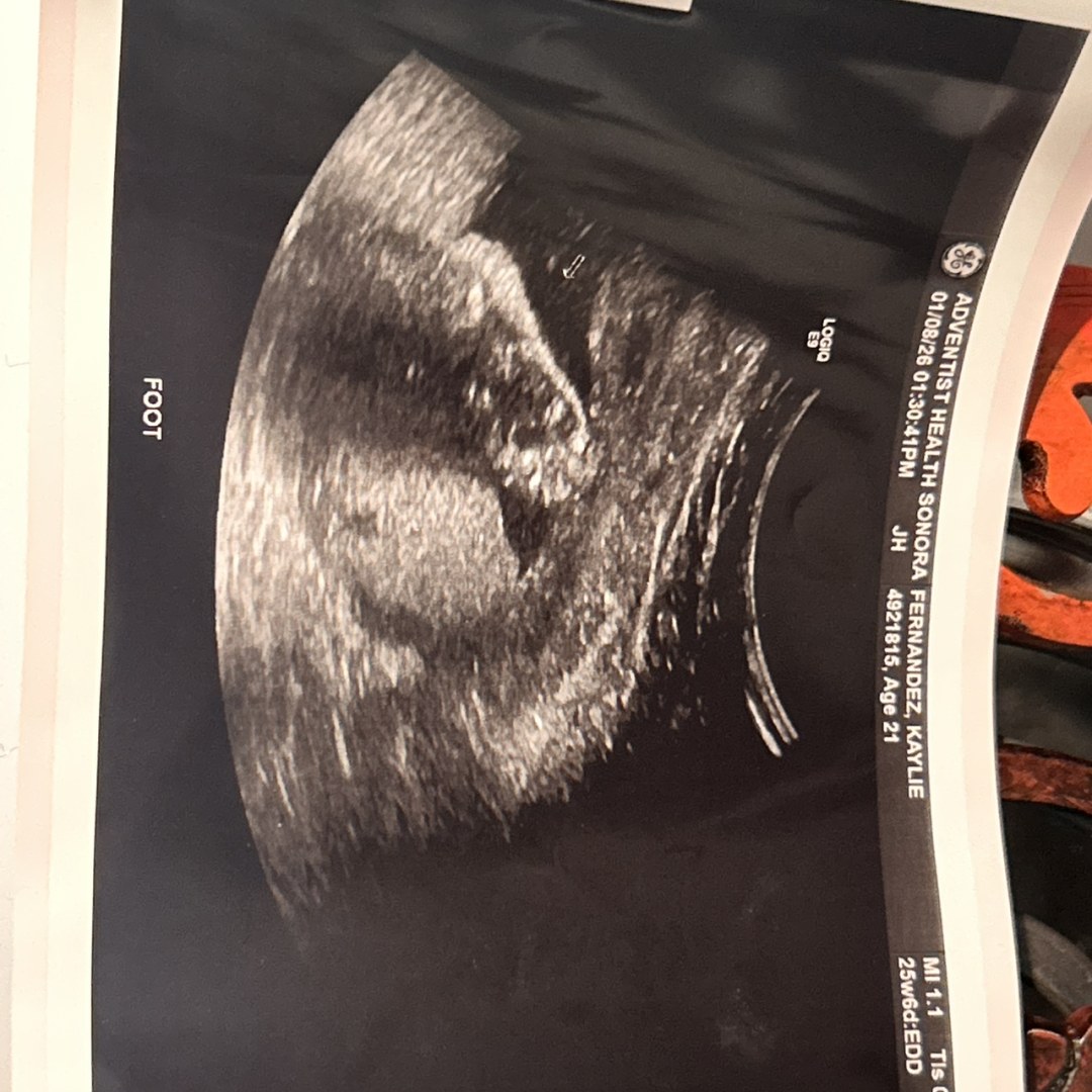 Photo shared by Kaylie for their Babylist baby registry.