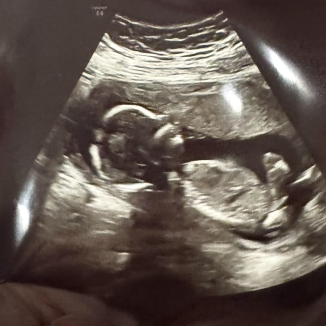 Photo shared by Kelsie for their Babylist baby registry.