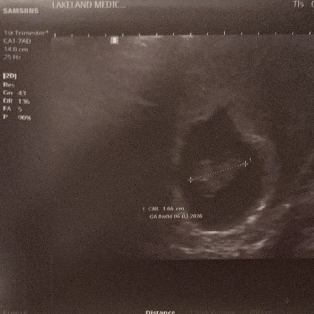 Photo shared by Amber for their Babylist baby registry.