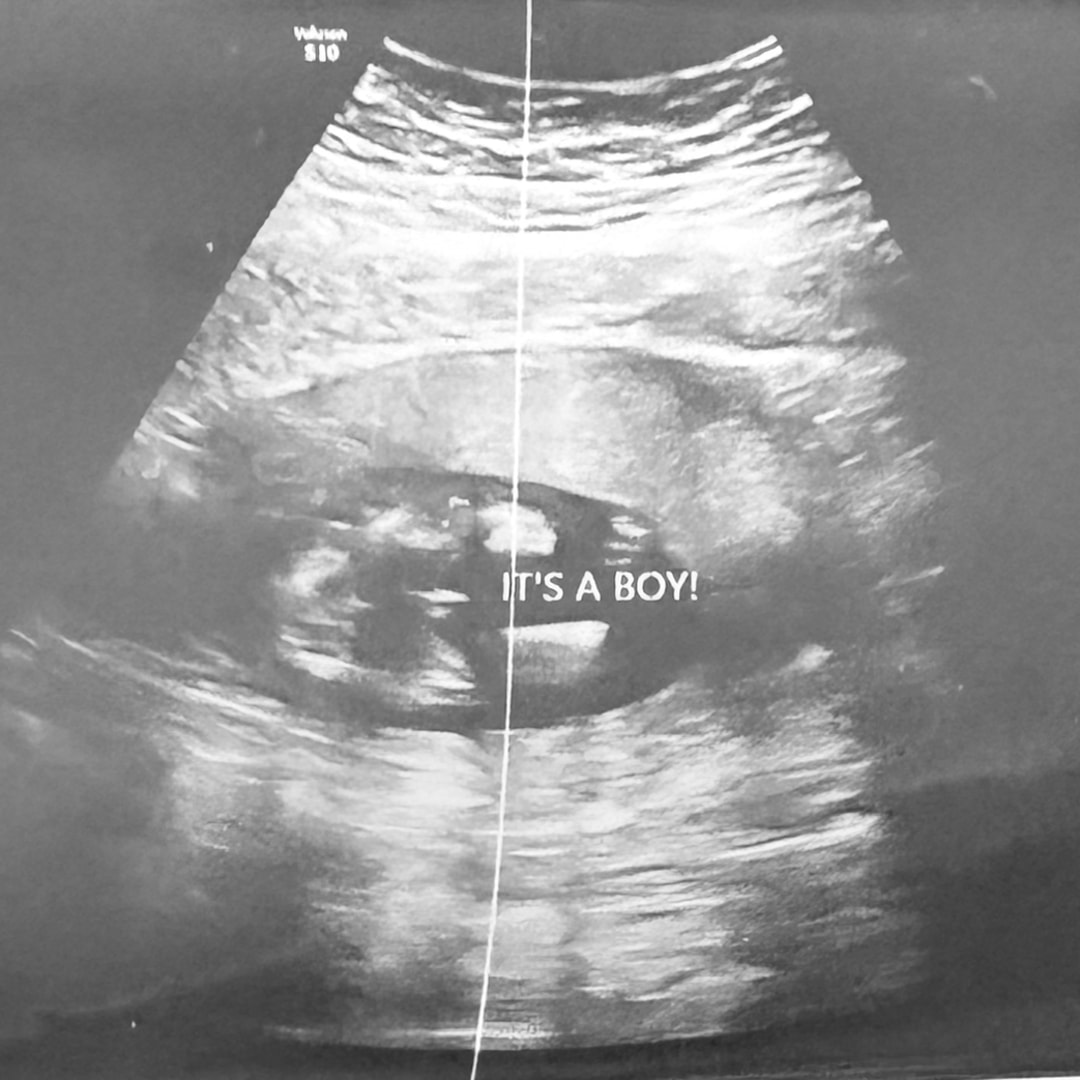 Photo shared by Bailee for their Babylist baby registry.