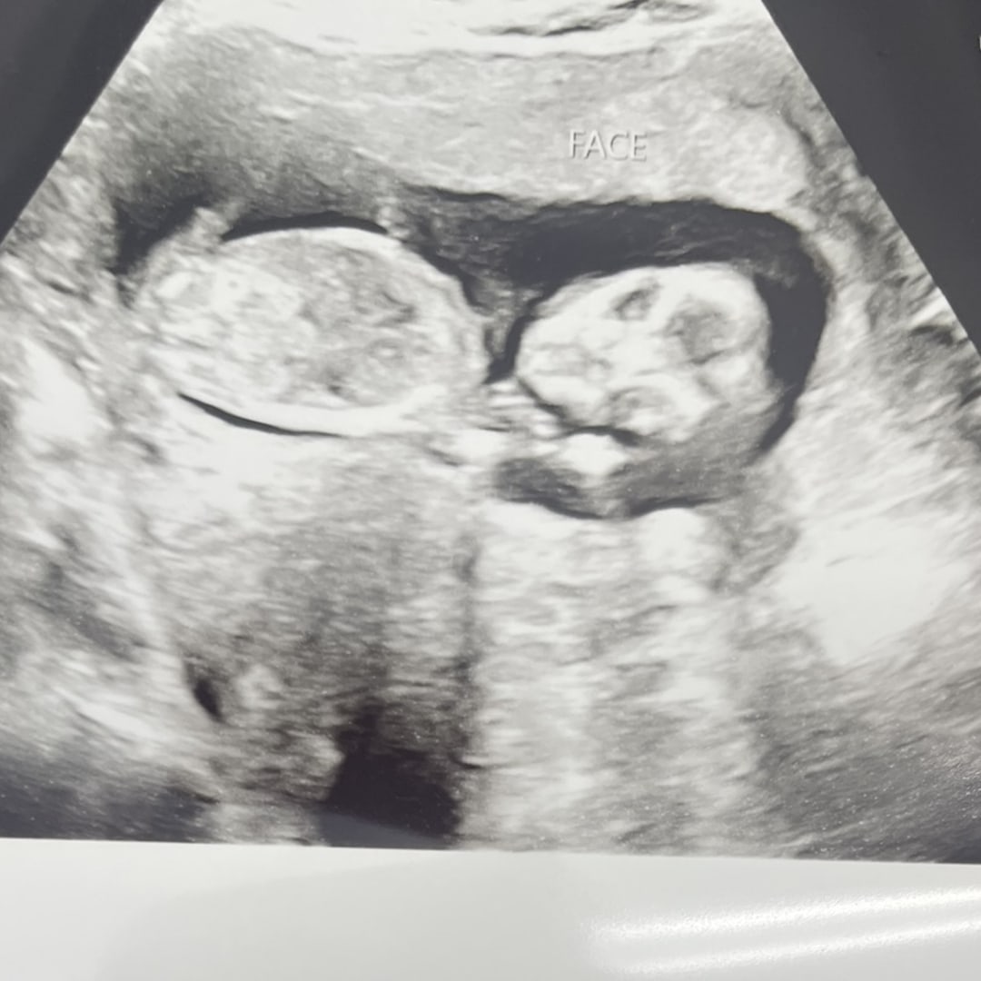 Photo shared by Victoria for their Babylist baby registry.