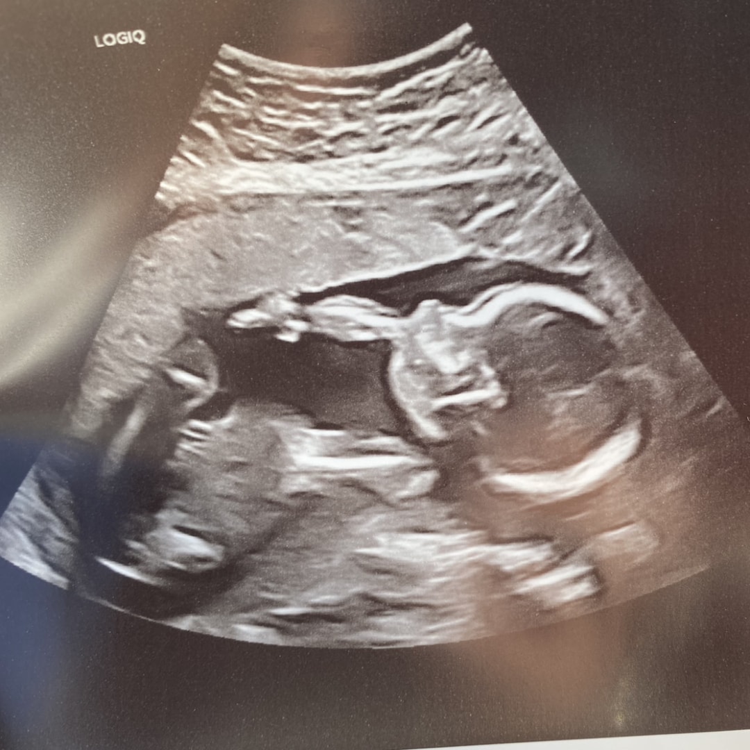 Photo shared by Josie for their Babylist baby registry.
