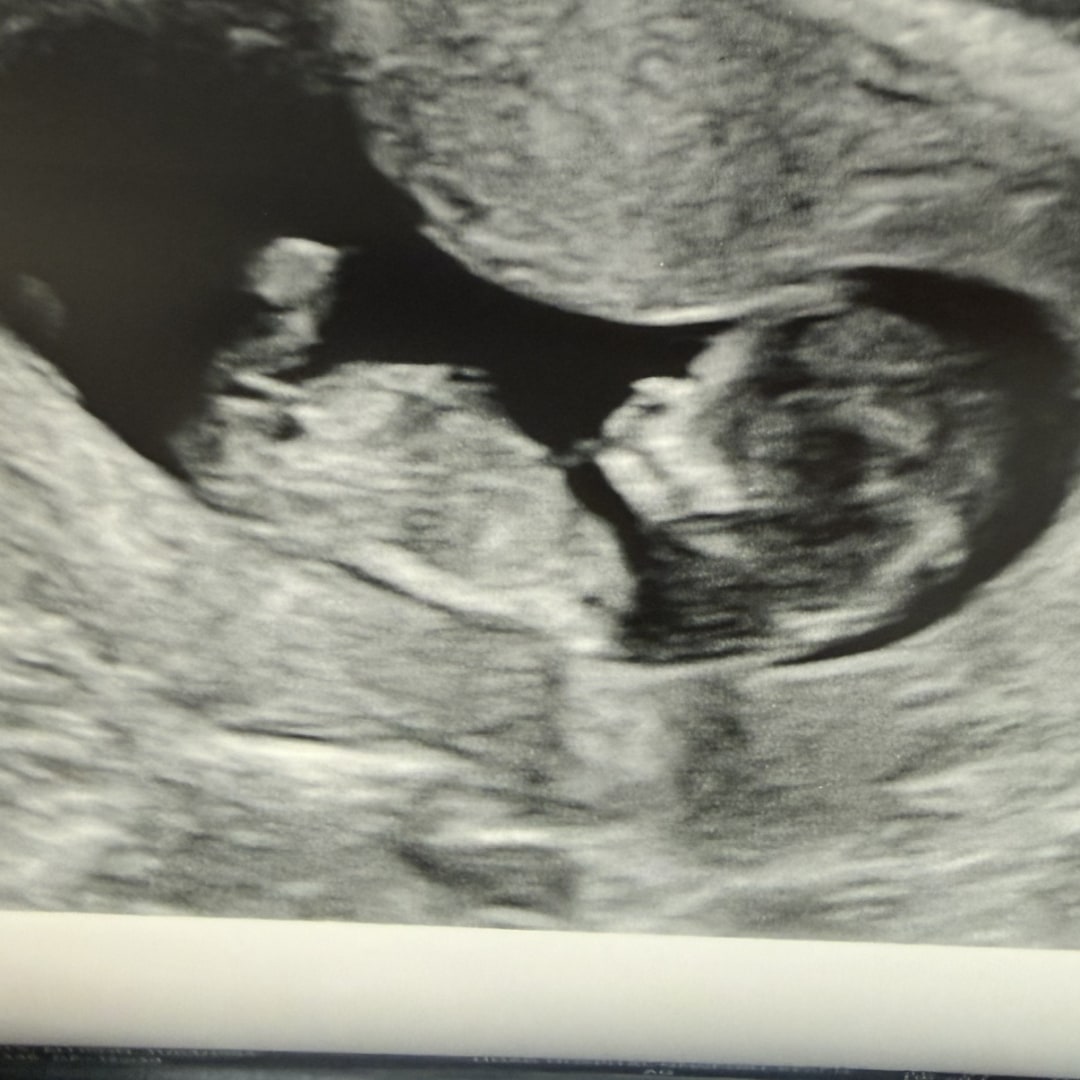 Photo shared by Allison for their Babylist baby registry.