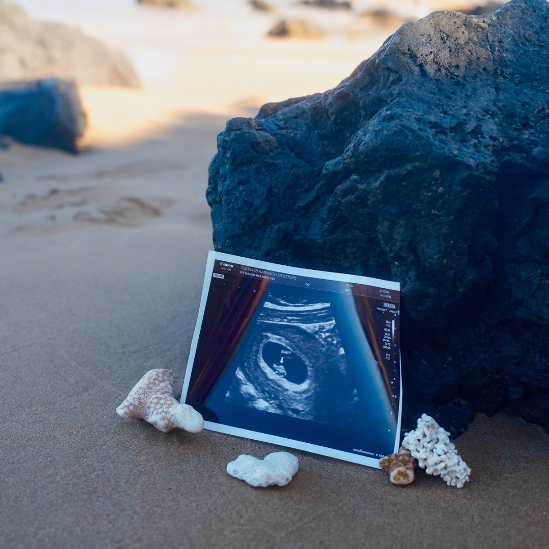 Photo shared by Destinee for their Babylist baby registry.