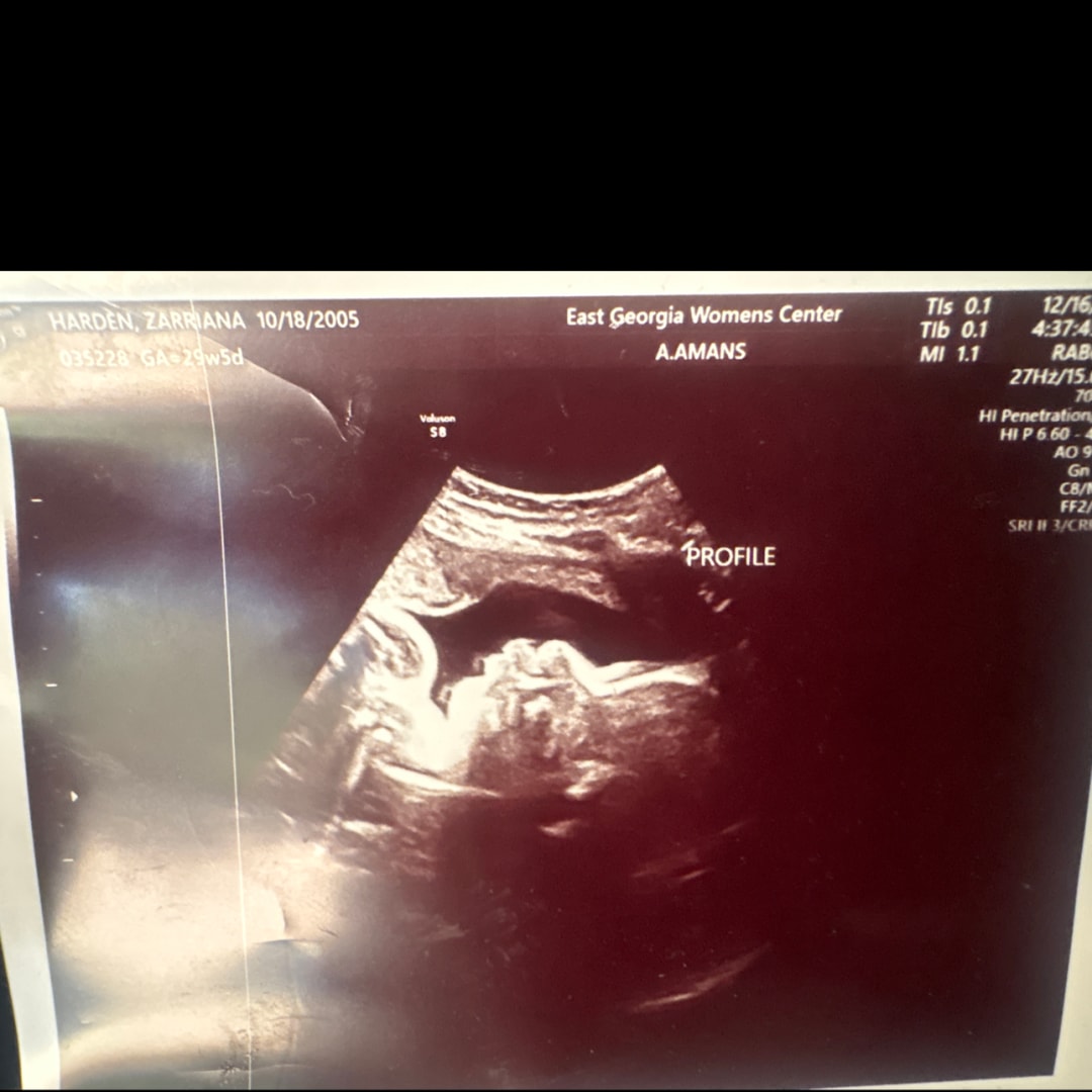 Photo shared by Zarriana for their Babylist baby registry.