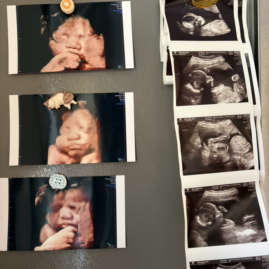 Photo shared by Ashlyn for their Babylist baby registry.