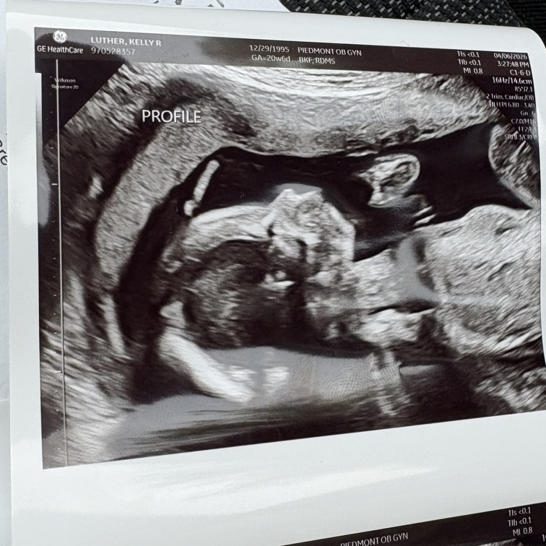 Photo shared by Kelly for their Babylist baby registry.