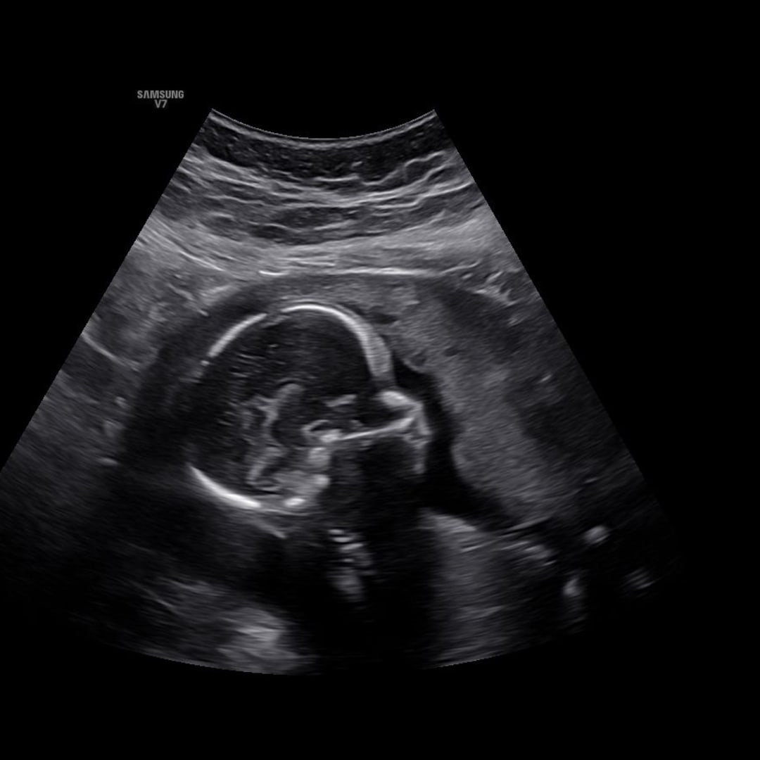 Photo shared by Lillian for their Babylist baby registry.