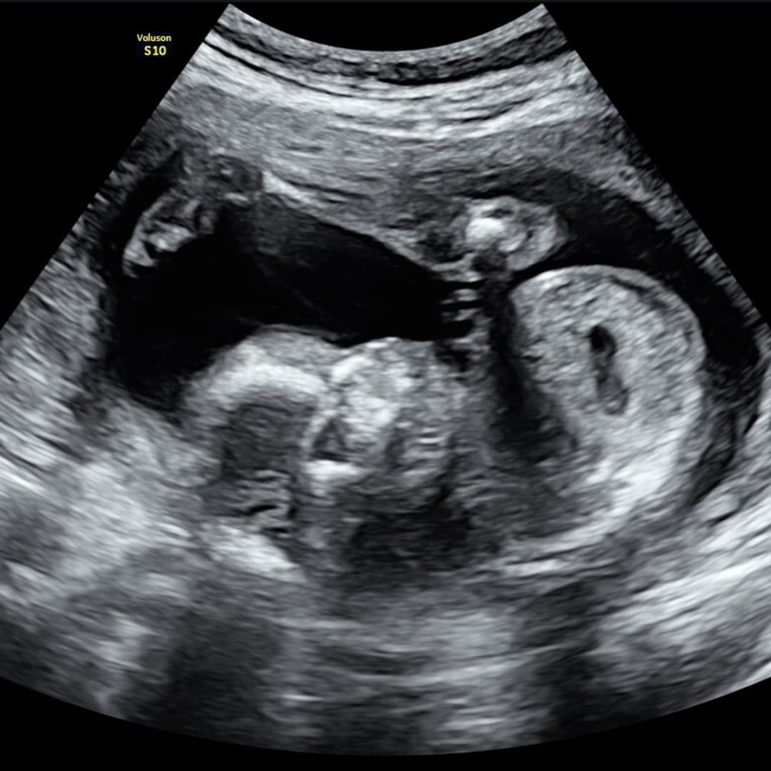 Photo shared by Jennifer for their Babylist baby registry.