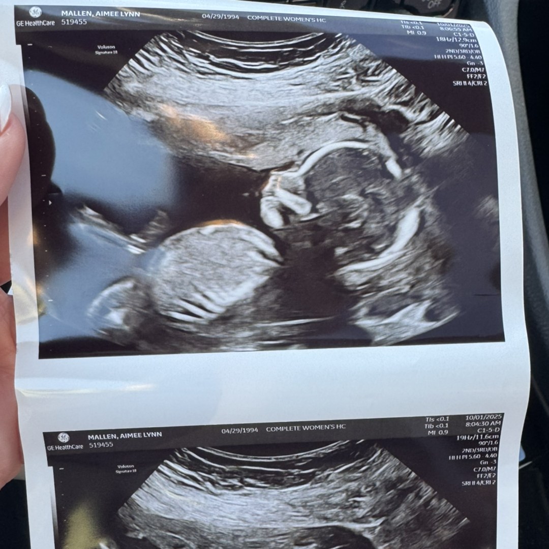 Photo shared by Aimee for their Babylist baby registry.