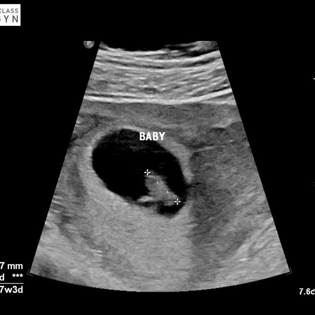 Photo shared by Giovanna for their Babylist baby registry.