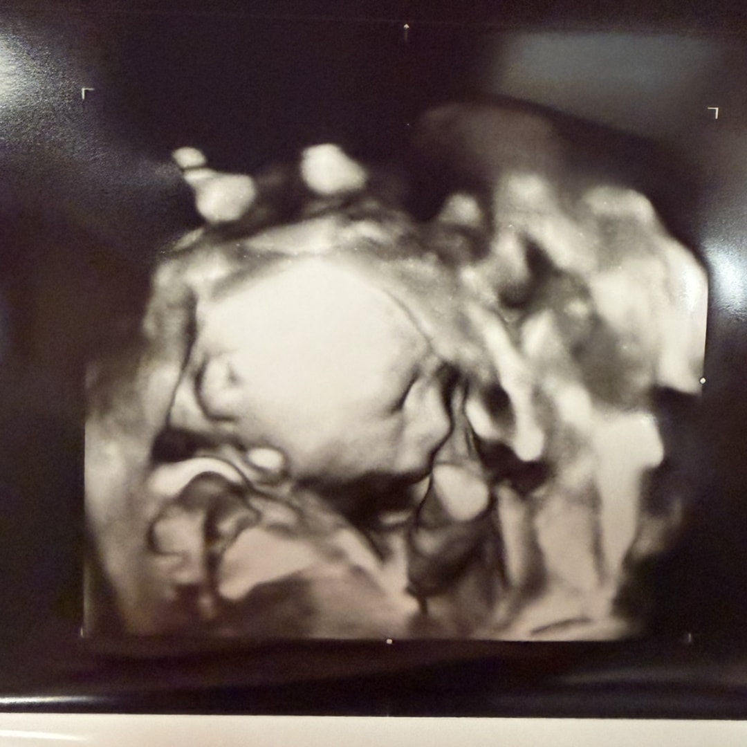 Photo shared by Mareena for their Babylist baby registry.
