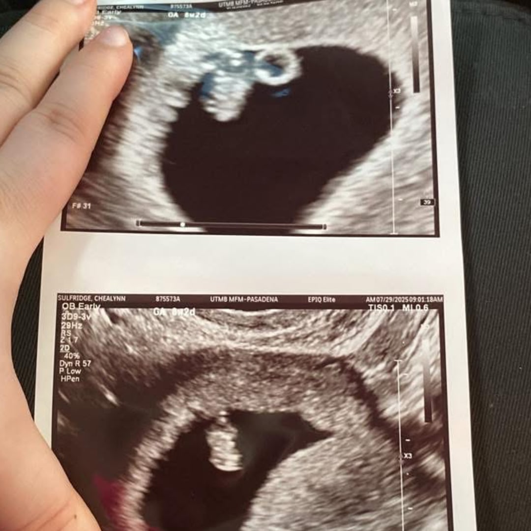 Photo shared by Chealynn for their Babylist baby registry.