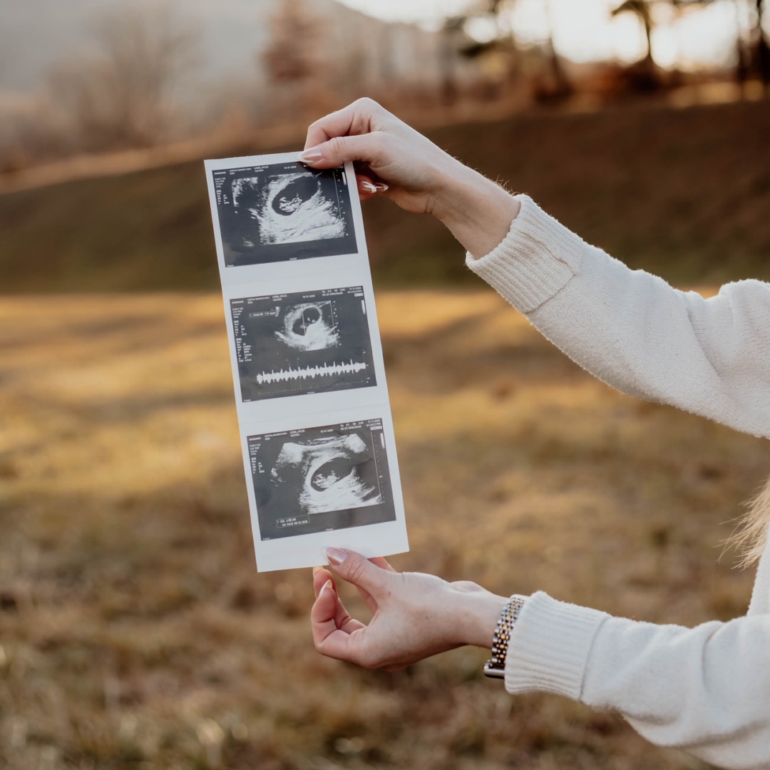 Photo shared by Atlee for their Babylist baby registry.