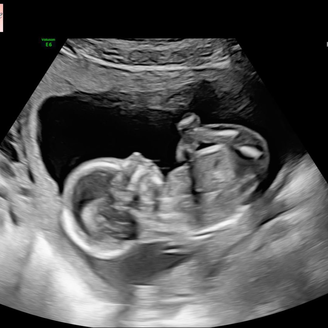 Photo shared by Casandra for their Babylist baby registry.