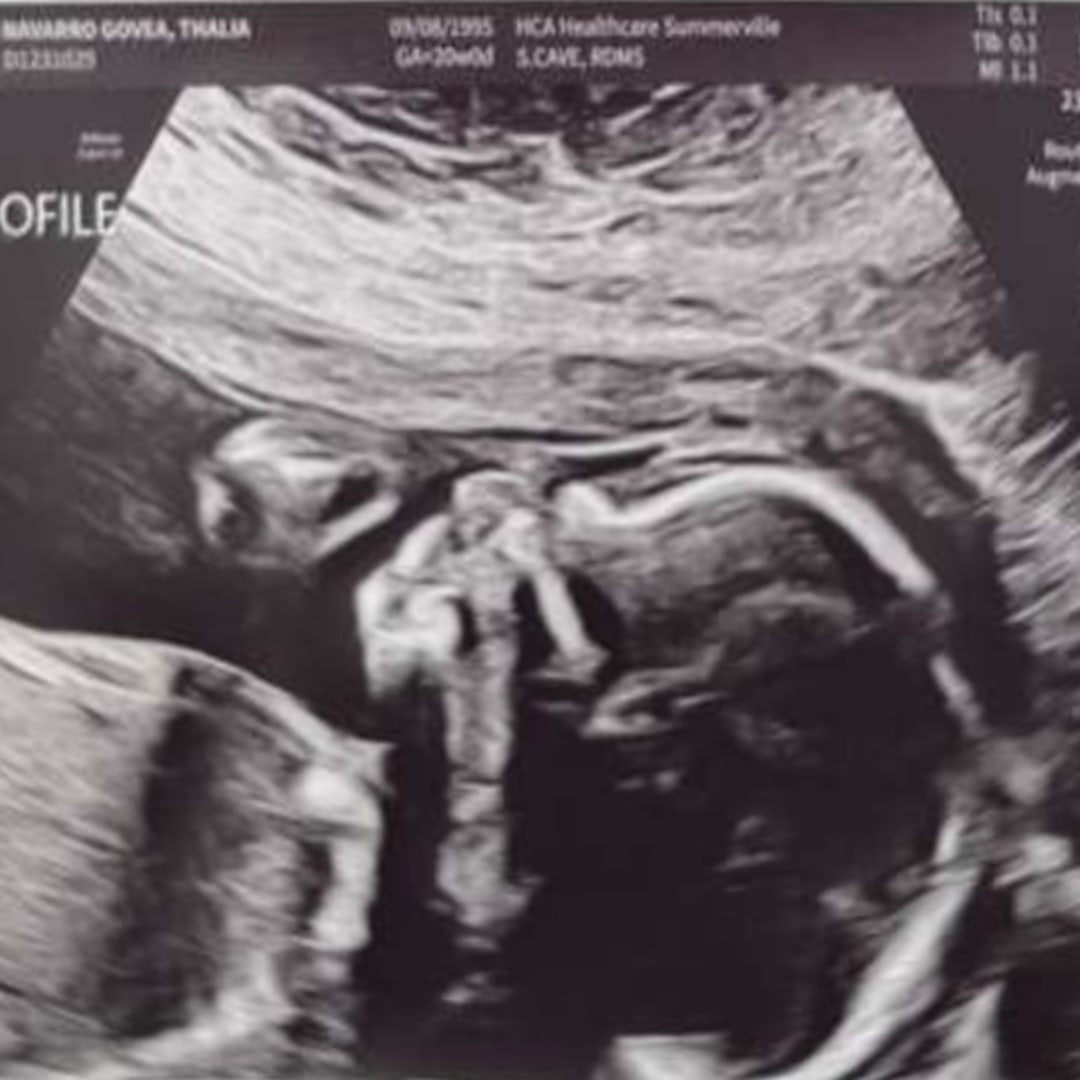 Photo shared by Thalia for their Babylist baby registry.