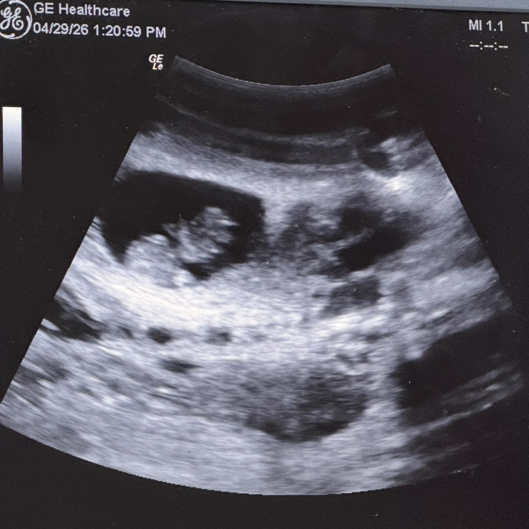 Photo shared by Kierra for their Babylist baby registry.
