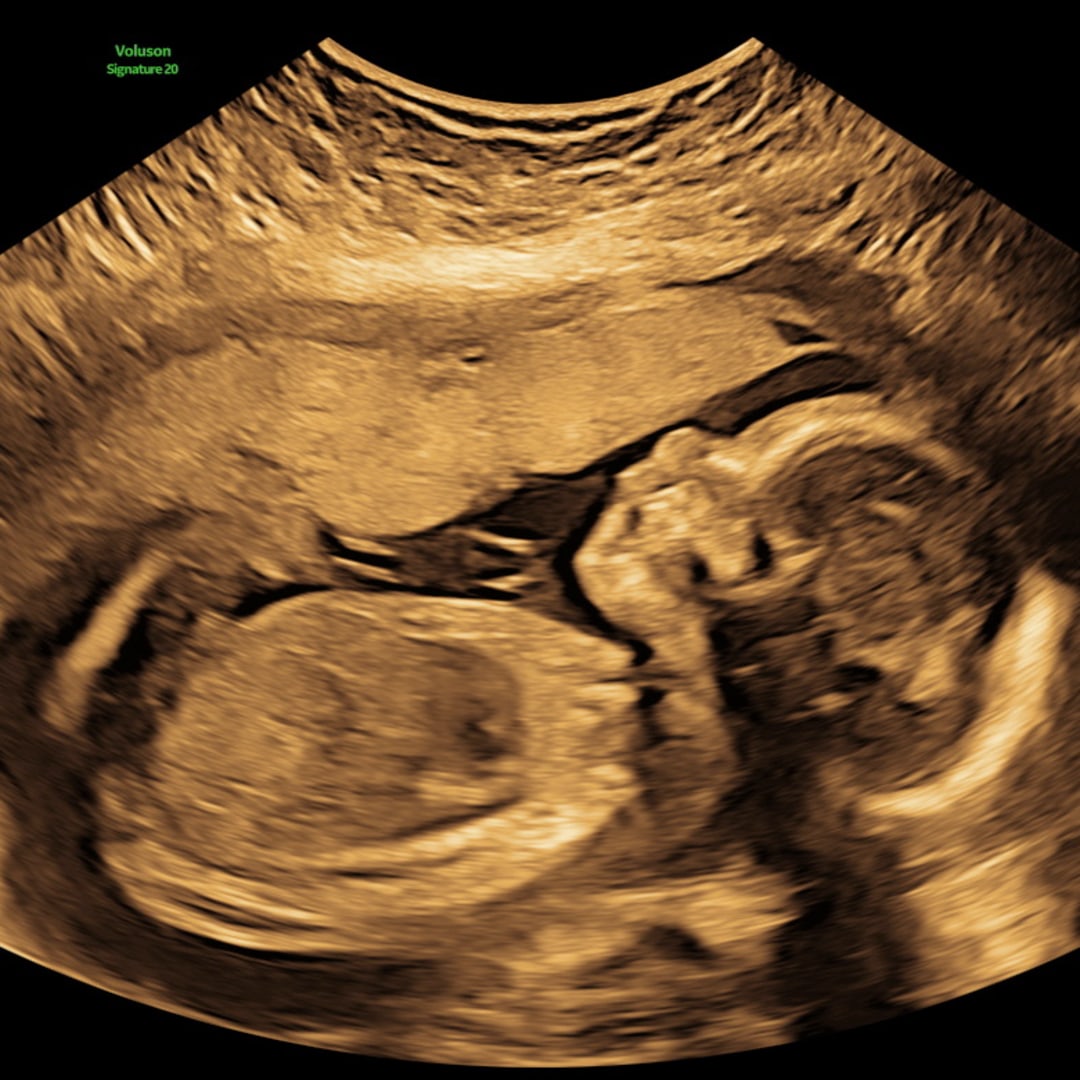 Photo shared by Lorey for their Babylist baby registry.