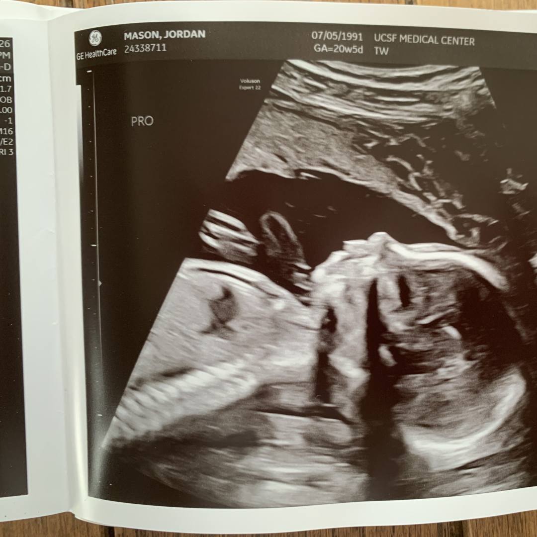 Photo shared by Jordan for their Babylist baby registry.