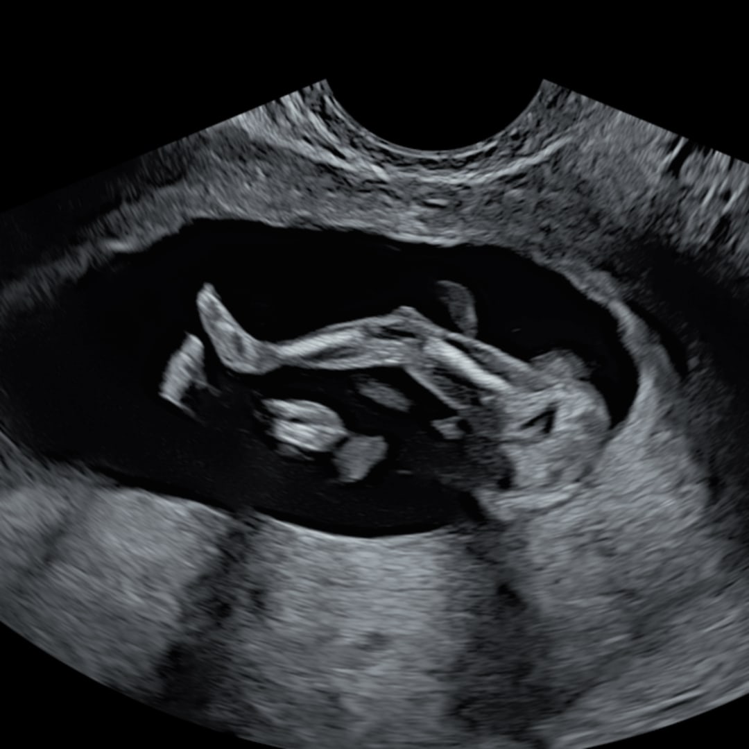 Photo shared by Deb for their Babylist baby registry.