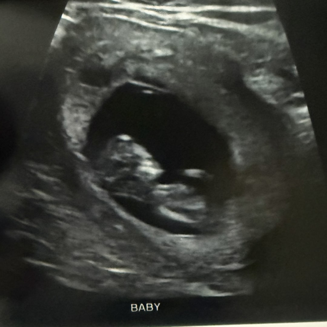 Photo shared by Lauren for their Babylist baby registry.