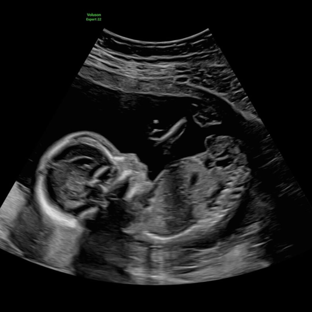 Photo shared by Georgia for their Babylist baby registry.