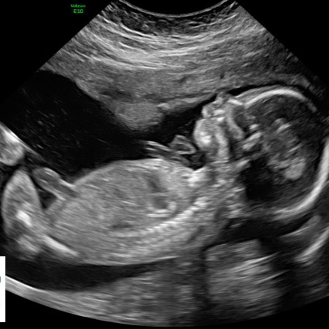 Photo shared by Melissa for their Babylist baby registry.
