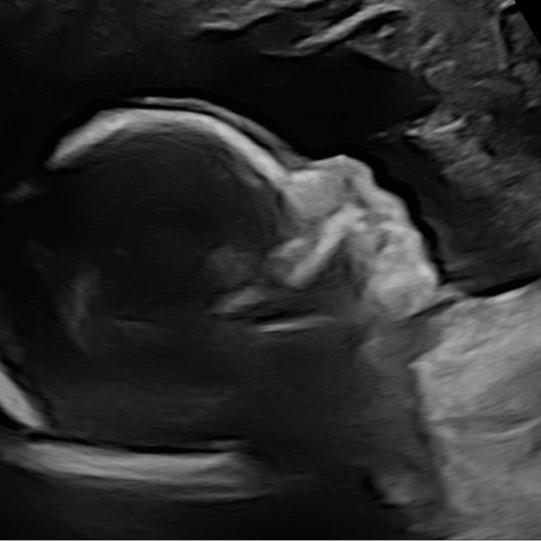 Photo shared by Ashley for their Babylist baby registry.