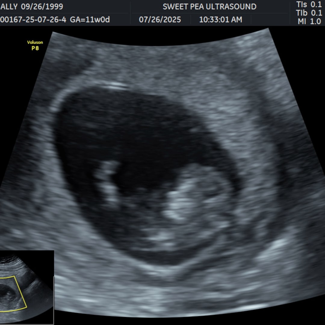 Photo shared by Ally for their Babylist baby registry.