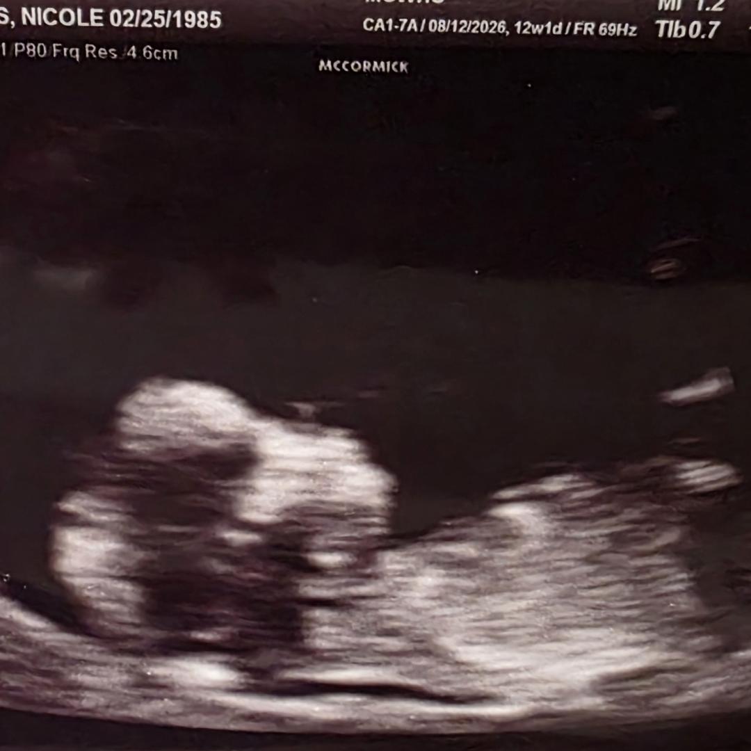 Photo shared by Nicole for their Babylist baby registry.