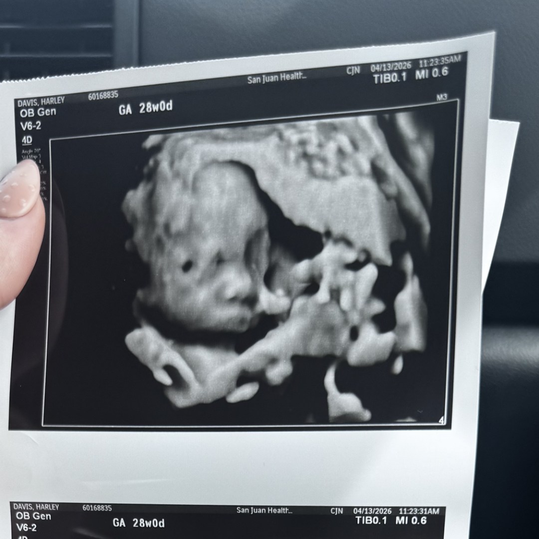 Photo shared by Harley for their Babylist baby registry.