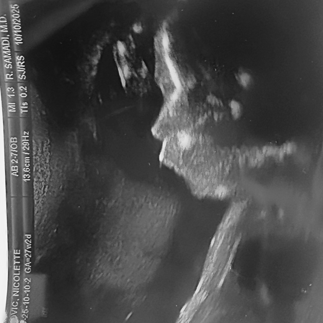 Photo shared by Nikki for their Babylist baby registry.