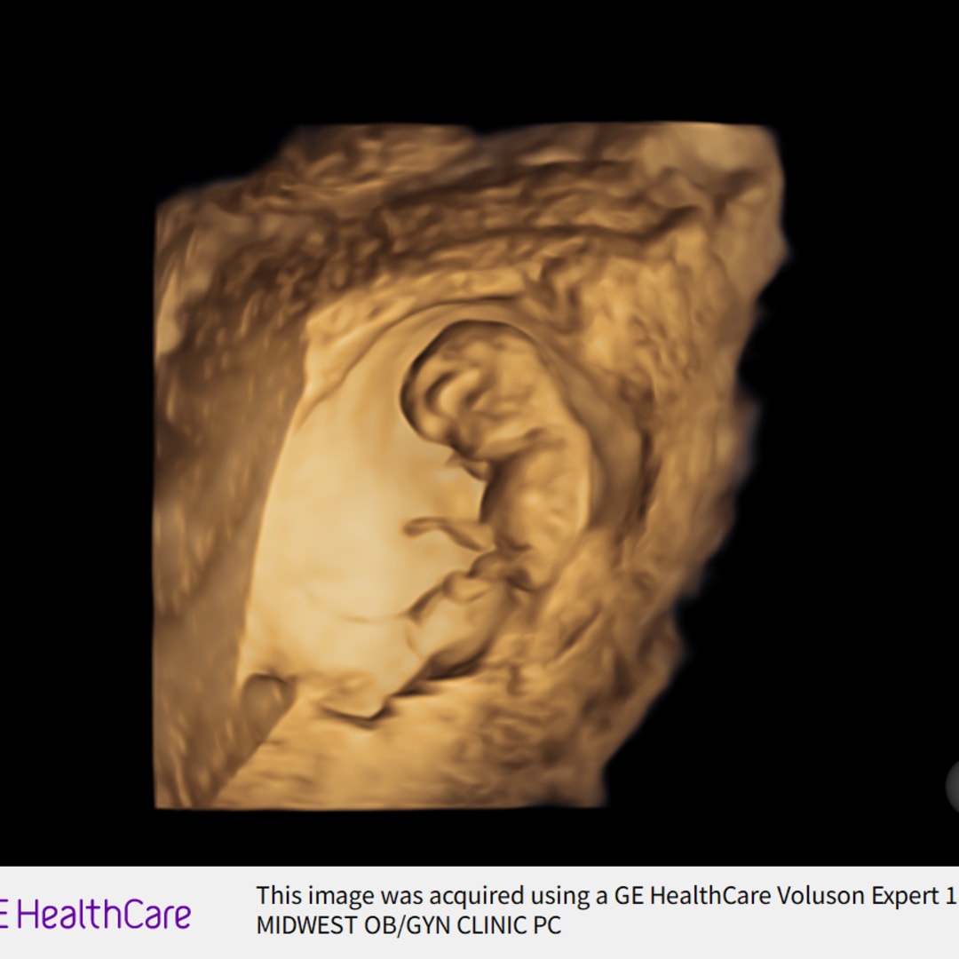 Photo shared by April for their Babylist baby registry.