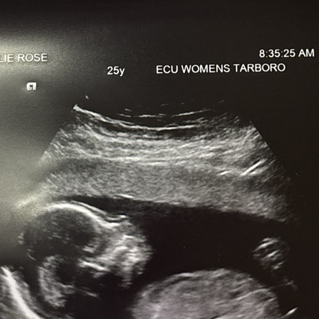 Photo shared by Leslie for their Babylist baby registry.