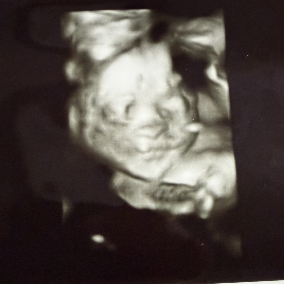 Photo shared by Alexis for their Babylist baby registry.