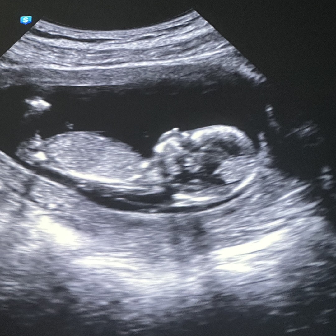 Photo shared by Cassie for their Babylist baby registry.