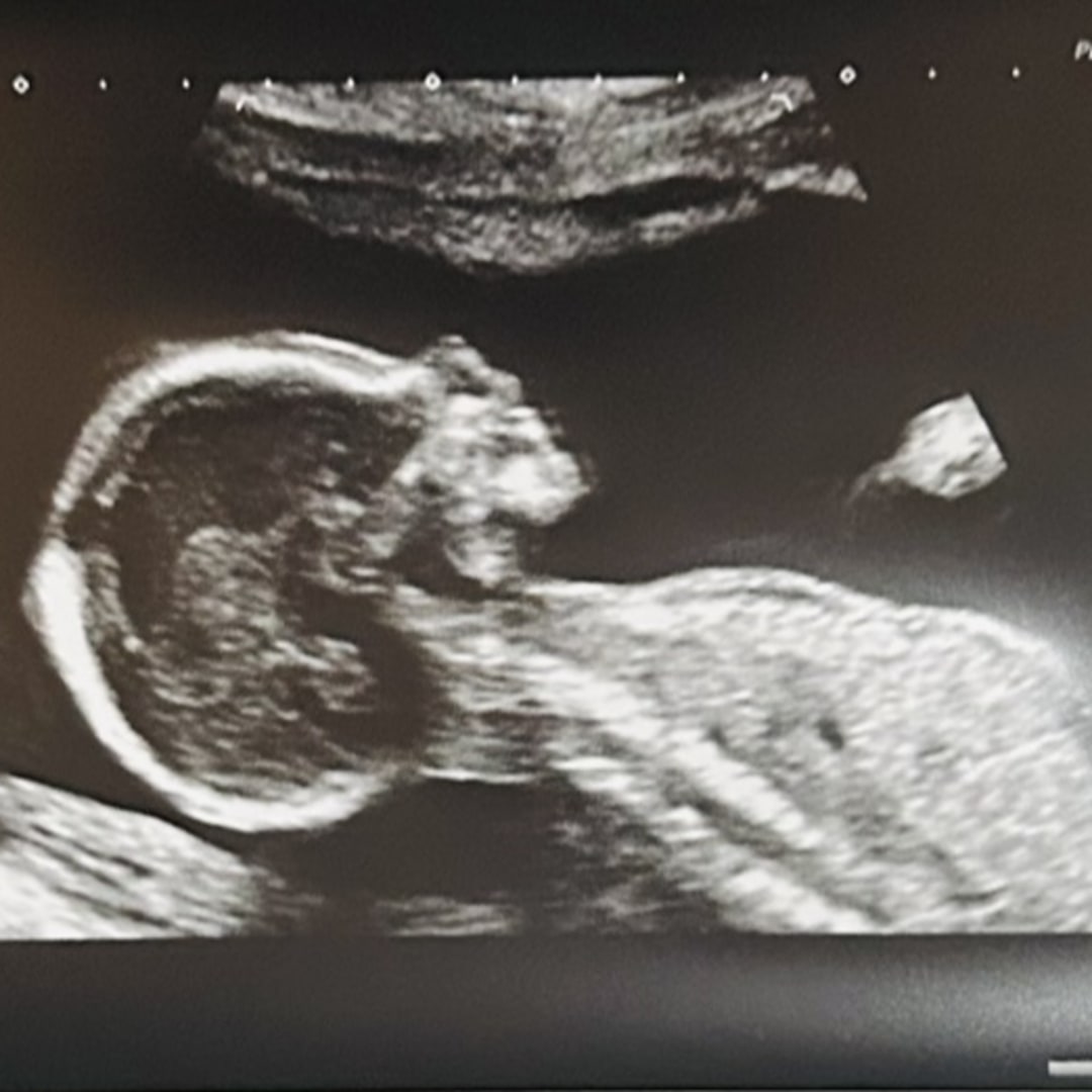 Photo shared by Cheyenne for their Babylist baby registry.