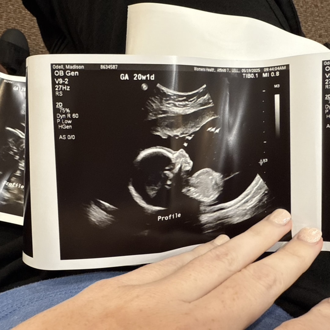 Photo shared by Madison for their Babylist baby registry.
