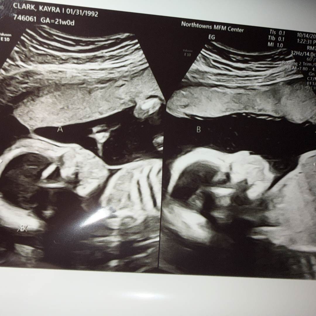 Photo shared by Kayra for their Babylist baby registry.