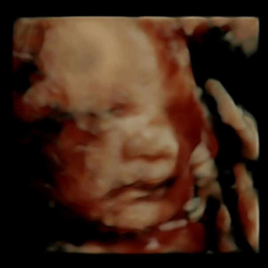 Photo shared by Kaitlyn for their Babylist baby registry.