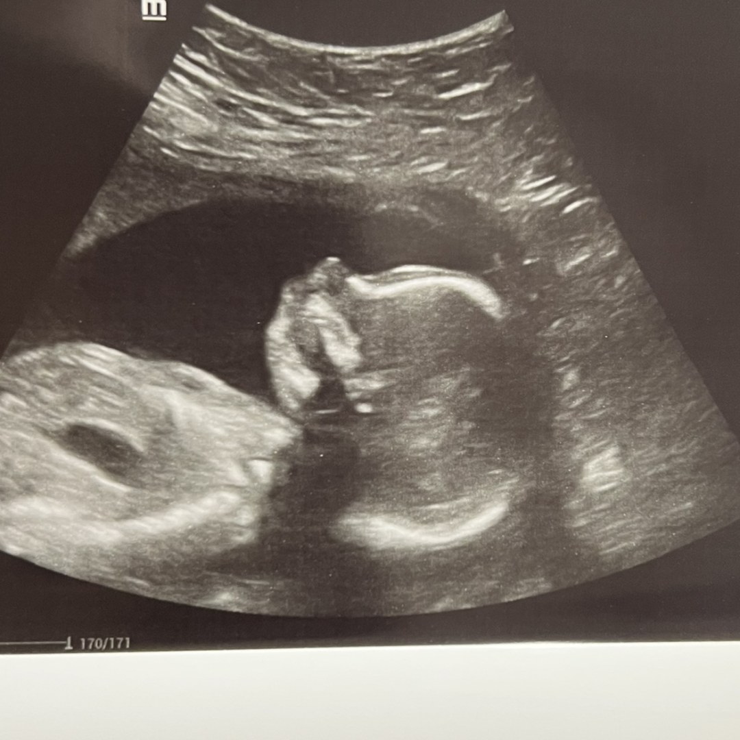 Photo shared by Casey for their Babylist baby registry.