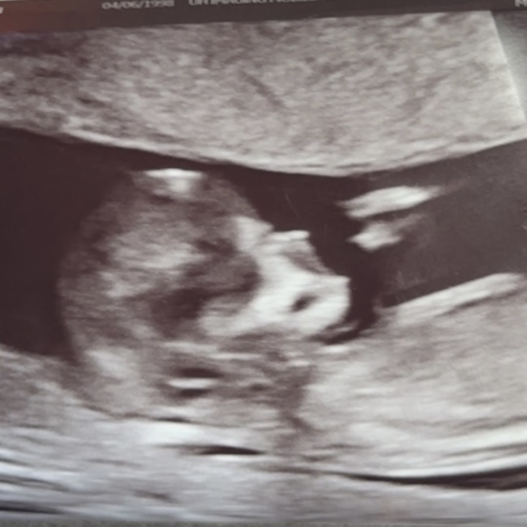 Photo shared by Haley for their Babylist baby registry.