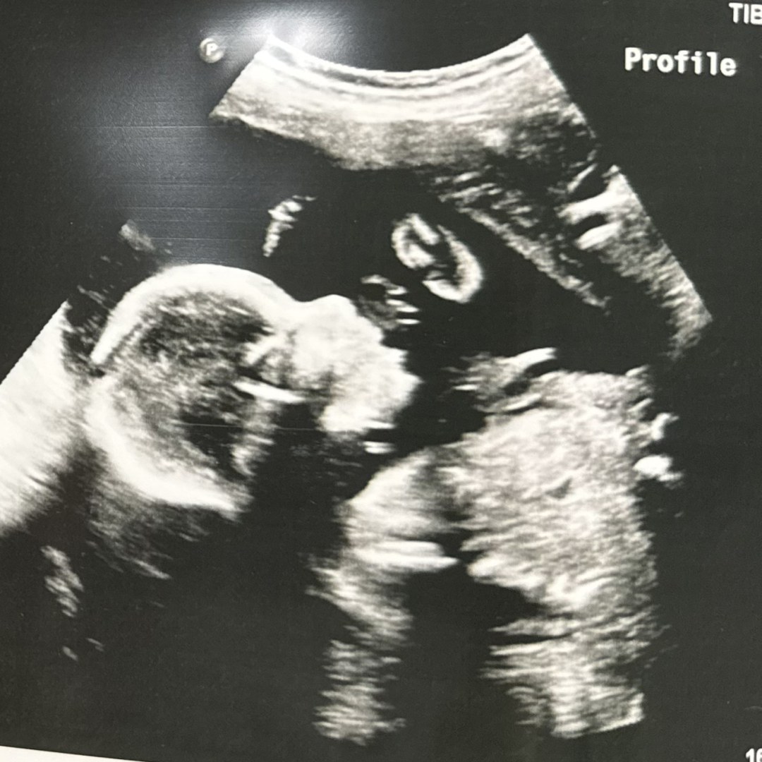 Photo shared by Samantha for their Babylist baby registry.