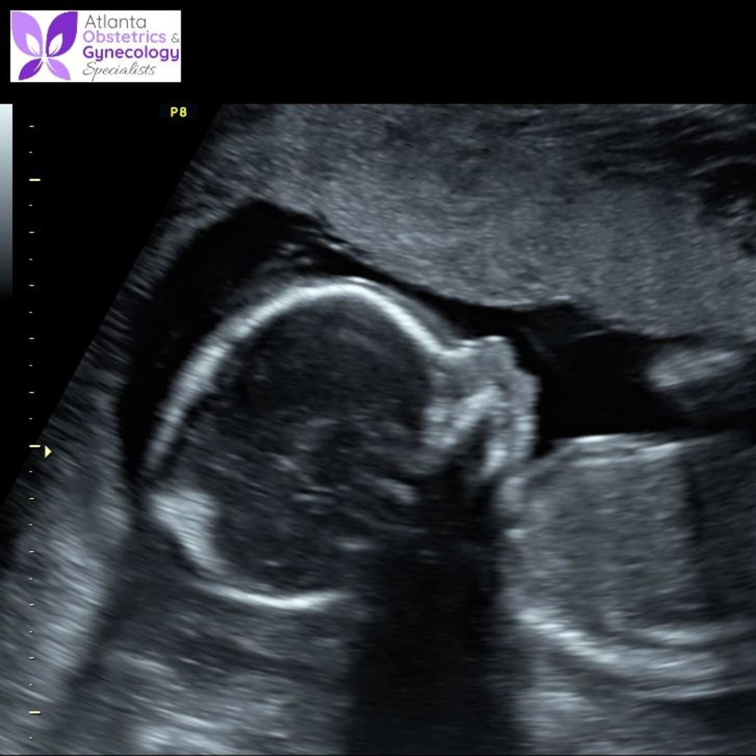 Photo shared by Sarah for their Babylist baby registry.