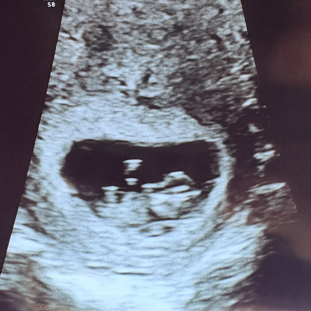 Photo shared by Alaina for their Babylist baby registry.