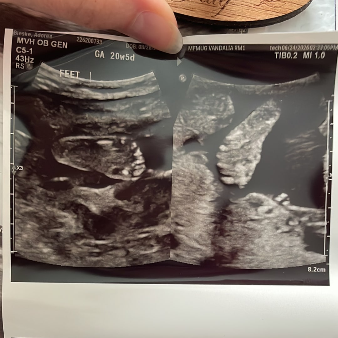 Photo shared by Adoree for their Babylist baby registry.