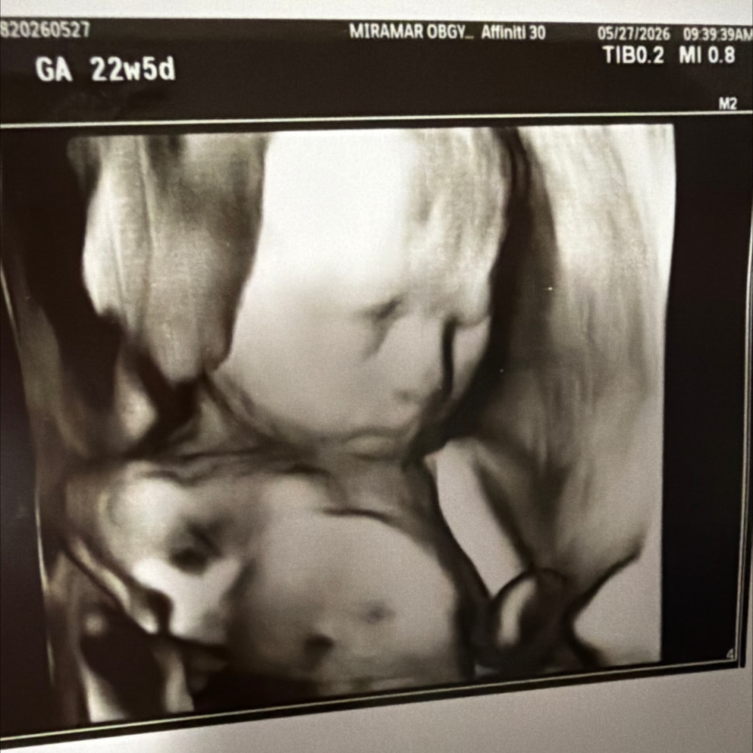 Photo shared by Christie for their Babylist baby registry.