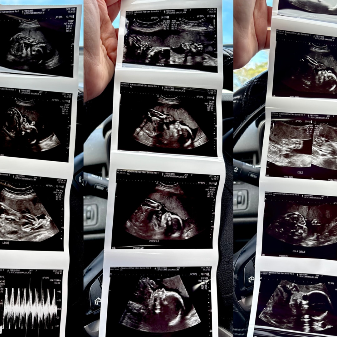 Photo shared by Makayla for their Babylist baby registry.