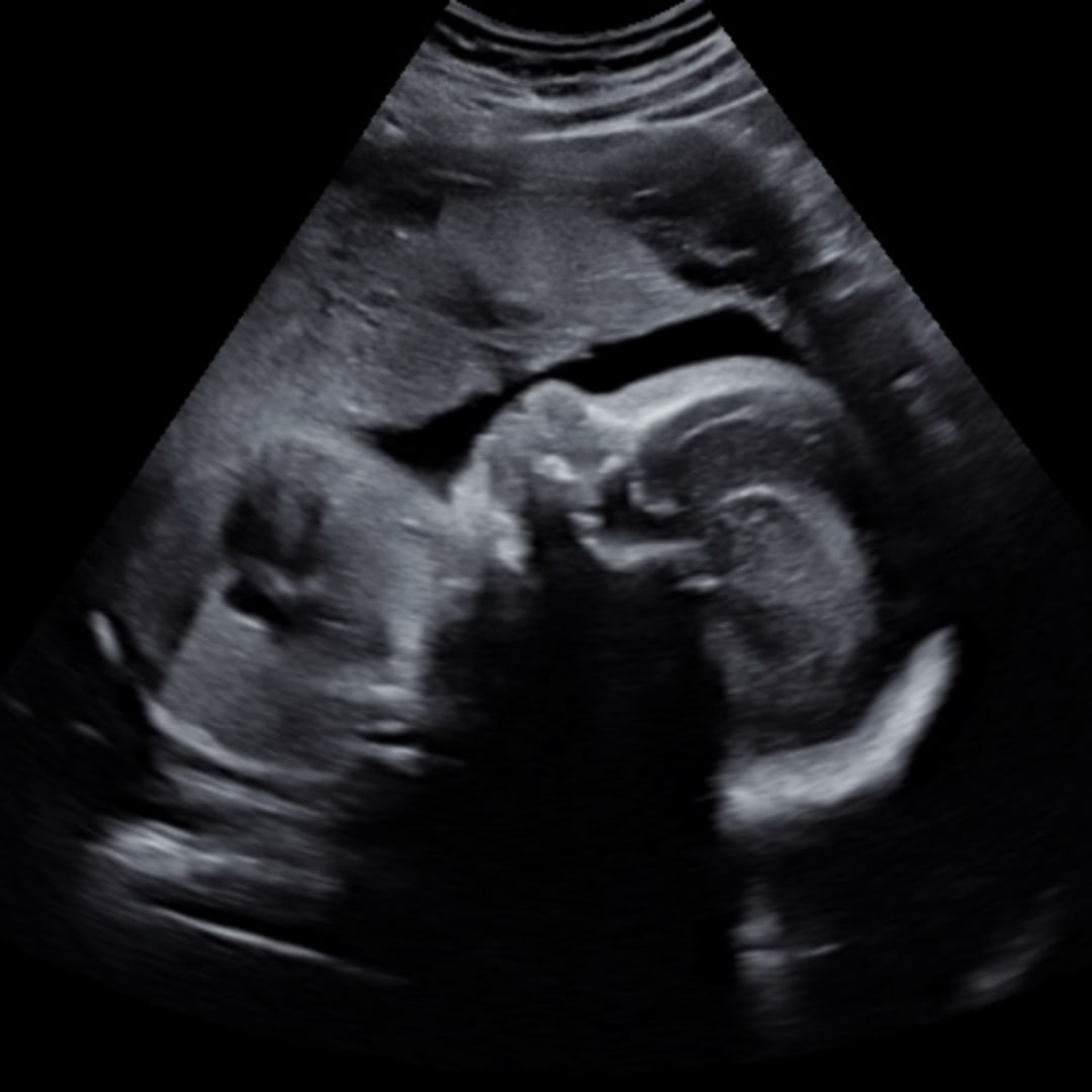 Photo shared by Myesha for their Babylist baby registry.