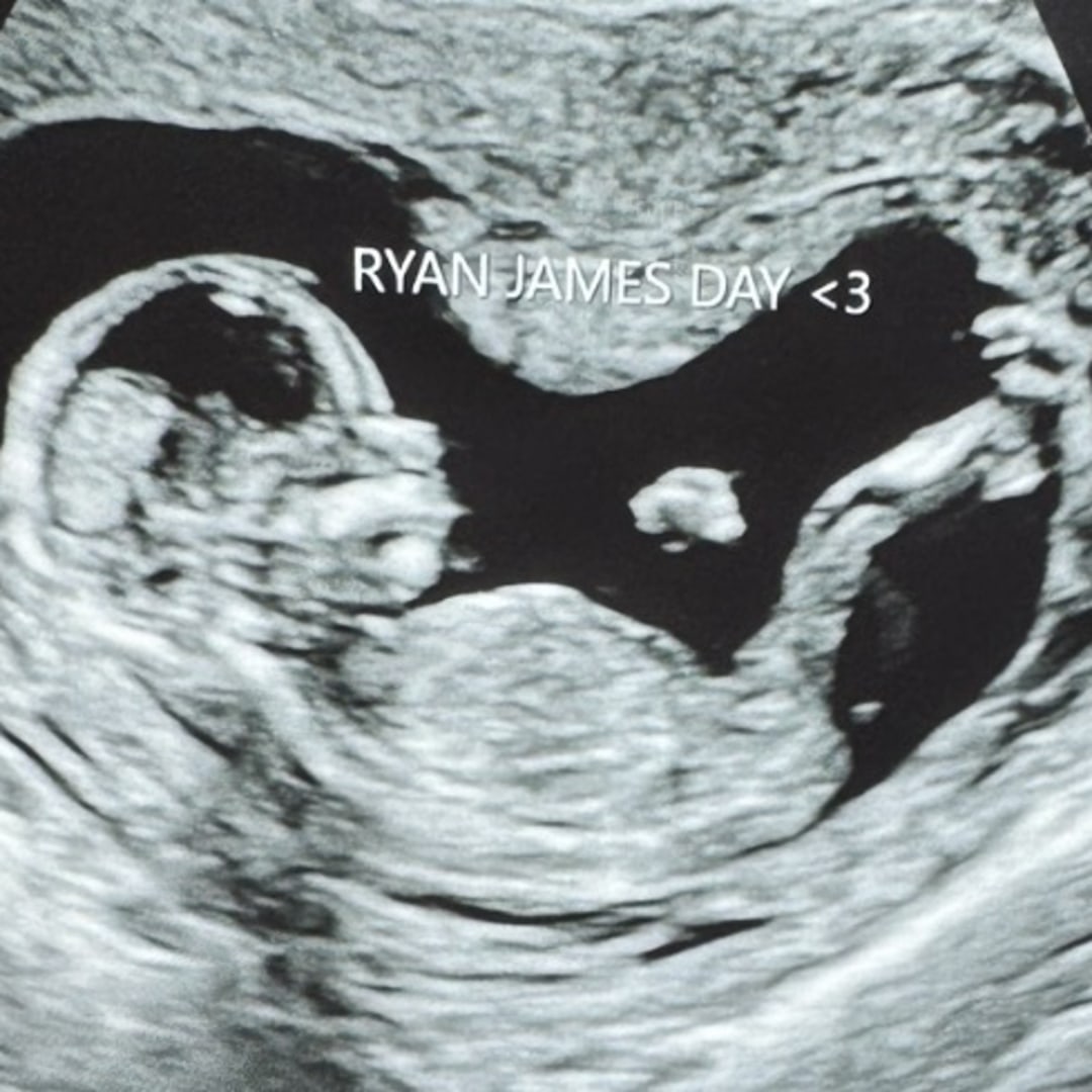 Photo shared by Nicolette for their Babylist baby registry.